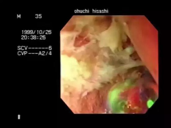 �����Ĥ����